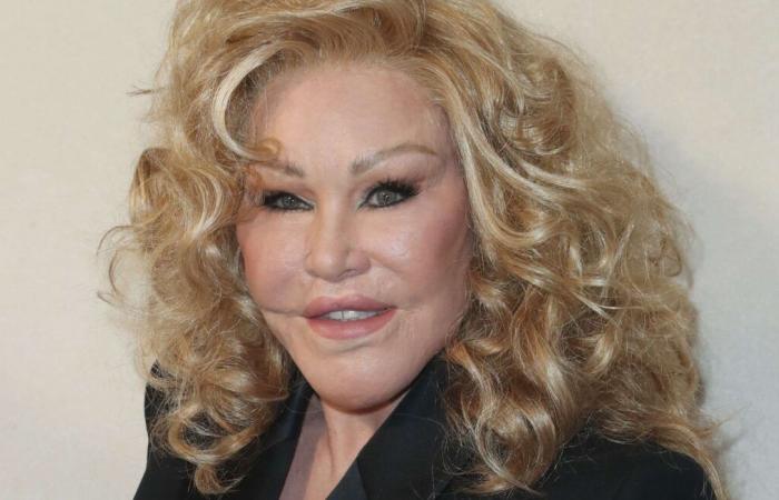 Dietro la morte di Jocelyne Wildenstein, “la donna gatto”, la storia di una delle più grandi truffatrici di tutti i tempi