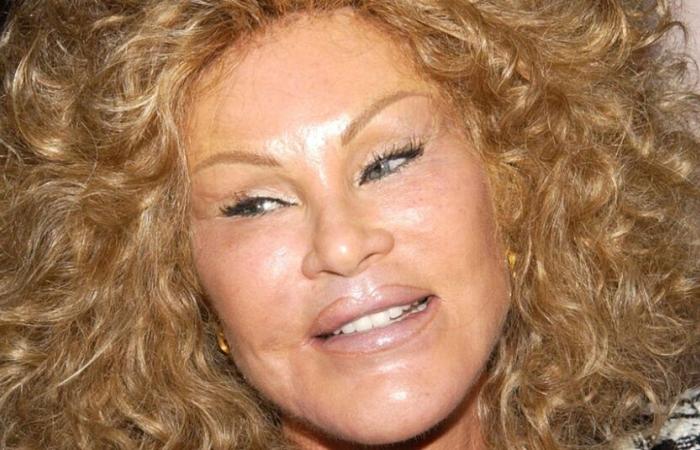 Jocelyne Wildenstein, mondana e “Catwoman” dei tabloid, muore a 79 anni