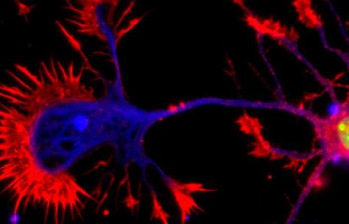 Come fa il cervello a prendere decisioni in situazioni inaspettate?