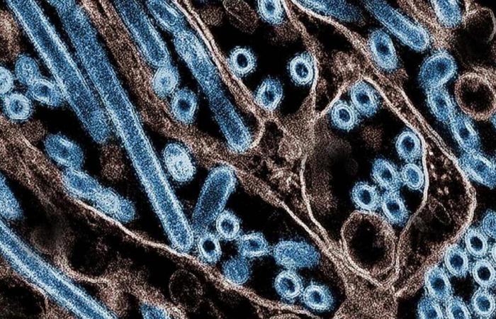 Morte di un paziente americano gravemente malato di influenza aviaria