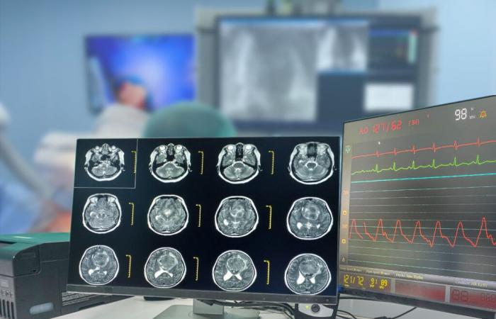 GLIOBLASTOMA: Prevenire la fuga di questo mortale tumore al cervello