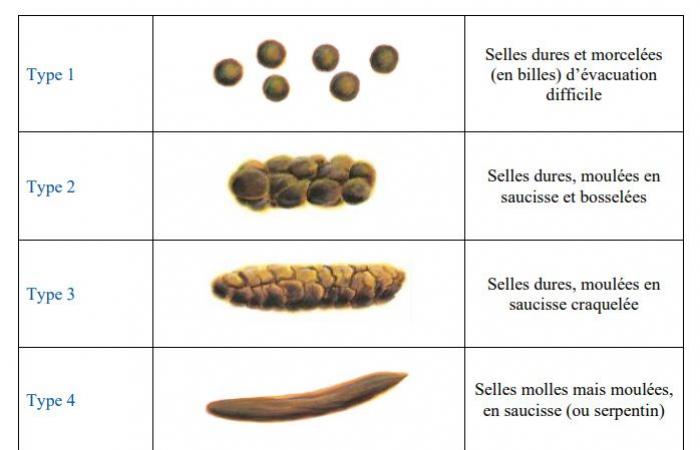 Scienza demistificante | Selle sul sedile caldo