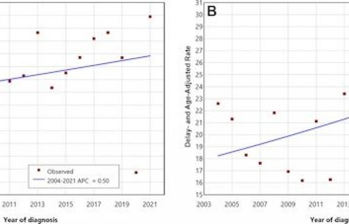 I tumori al seno avanzati sono in aumento negli Stati Uniti