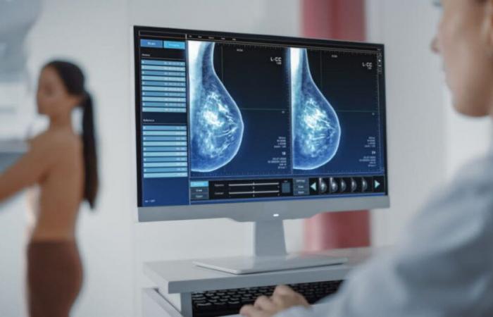 Salute. L’intelligenza artificiale potrebbe rivoluzionare lo screening del cancro al seno