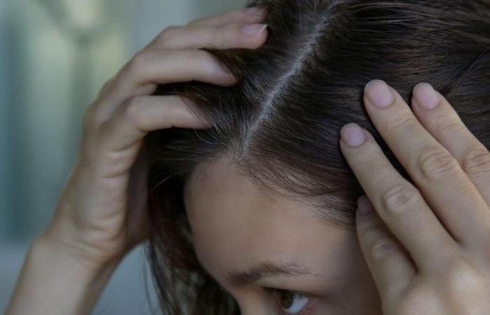 Perché le persone di 20-30 anni hanno i capelli grigi sempre prima?