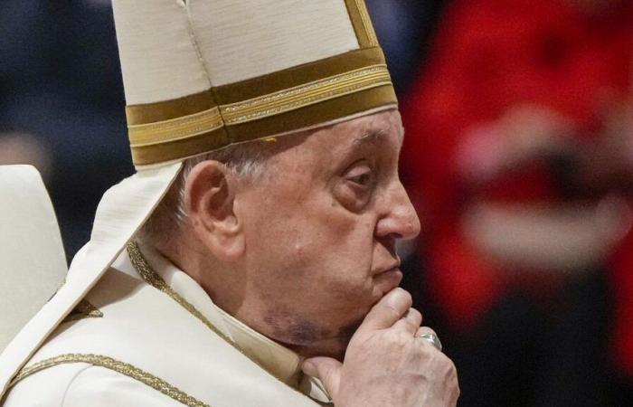 Papa Francesco si ferisce al braccio destro dopo un’altra caduta