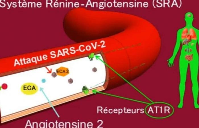 Importanti progressi nella cura delle malattie cardiovascolari