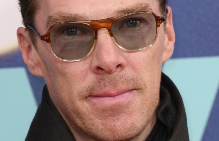 Benedict Cumberbatch porta le cicatrici del suo rapimento quando era giovane