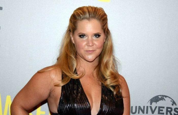 Amy Schumer ha sofferto della sindrome di Cushing