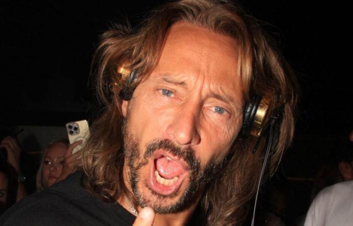 Bob Sinclar spiega finalmente la sua faccia trasformata