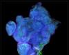 Scoperta di tumori di origine epigenetica senza mutazione del DNA