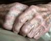 trovata morta una donna di 94 anni in una casa di riposo, aperta un’indagine per “violenza intenzionale”