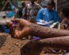 Mpox: lieve rallentamento della contaminazione in Africa