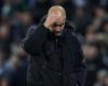 L'incredibile ammissione di Guardiola sulle sue ferite al viso